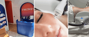 INEOSKIN